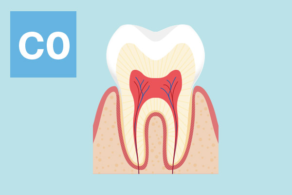 CO（シーオー）：虫歯になりかけの歯